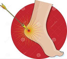  The Achilles' Heel
